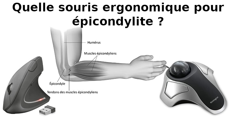 Quelle souris ergonomique pour épicondylite ?