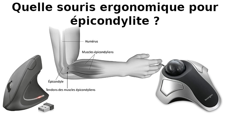 Marre des tendinites au poignet ? Cette souris ergonomique de